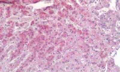 Immunohistochemistry-Paraffin: TIAM1 Antibody [NBP3-14495] - Human Adrenal: Formalin-Fixed, Paraffin-Embedded (FFPE)